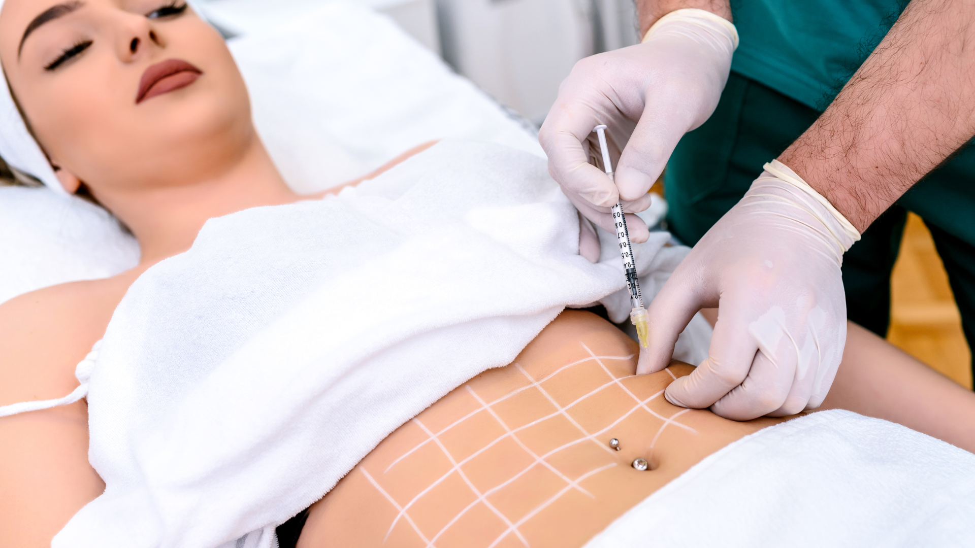 ¿Qué es la Mesoterapia Reductiva y Cómo Funciona? – Dermafrance