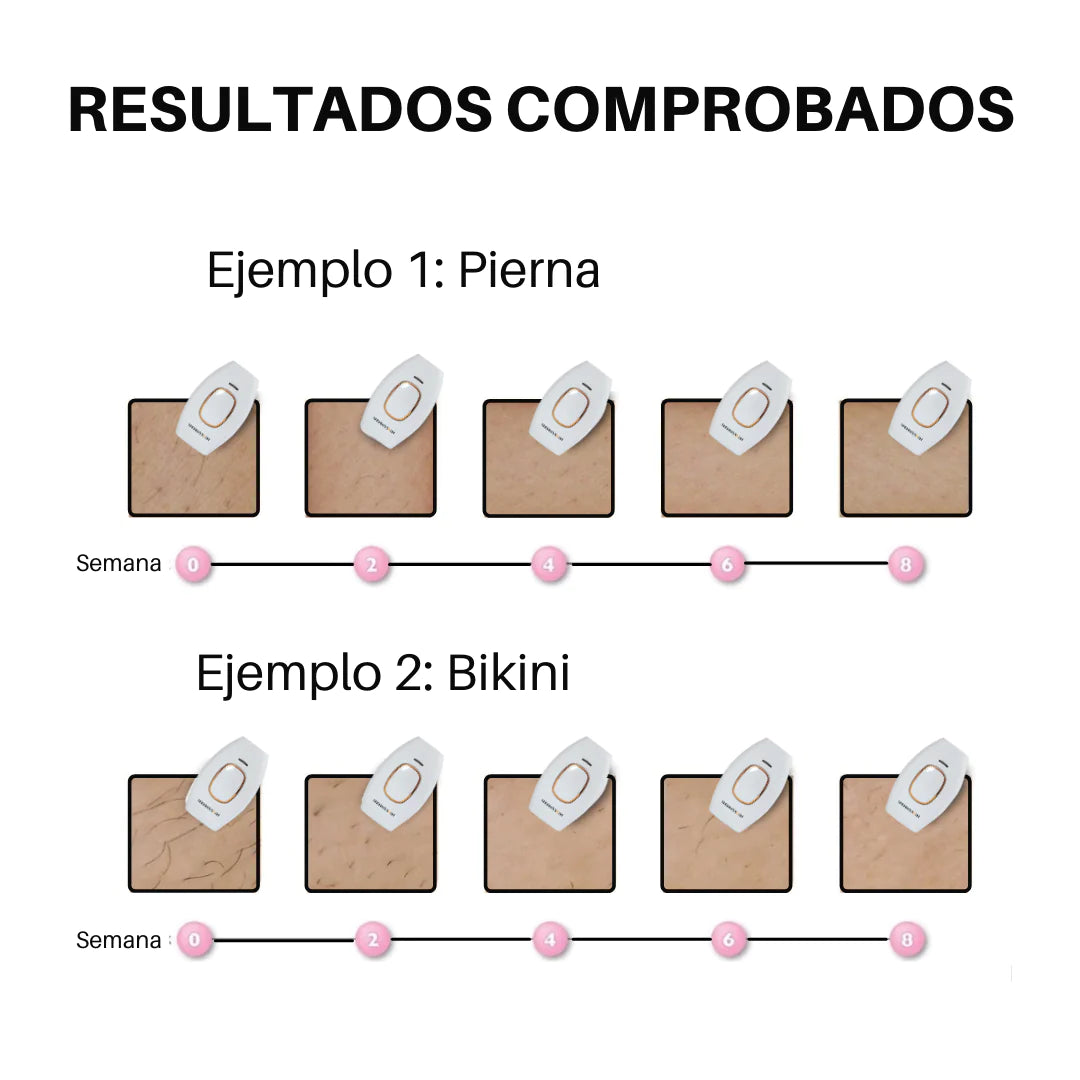 Depiladora Láser IPL – Eliminación Permanente y Sin Dolor para Todo el Cuerpo