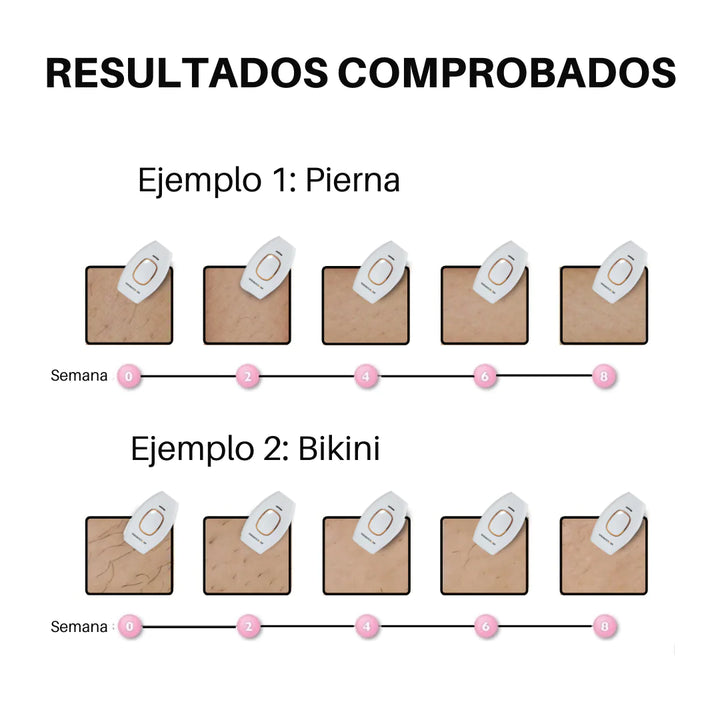 Depiladora Láser IPL – Eliminación Permanente y Sin Dolor para Todo el Cuerpo