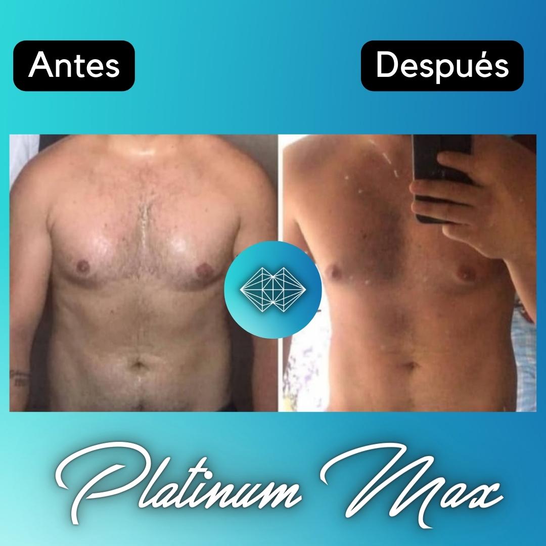 Lipo Enzimas - Dermafrance