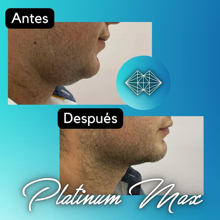 Lipo Enzimas - Dermafrance